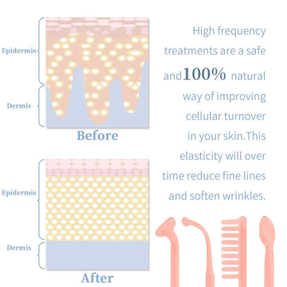 High Frequency Skin Therapy wand 4 in 1